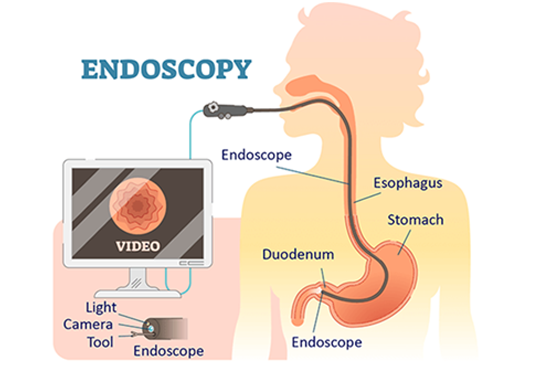Principle of Confocal Endomicroscopy